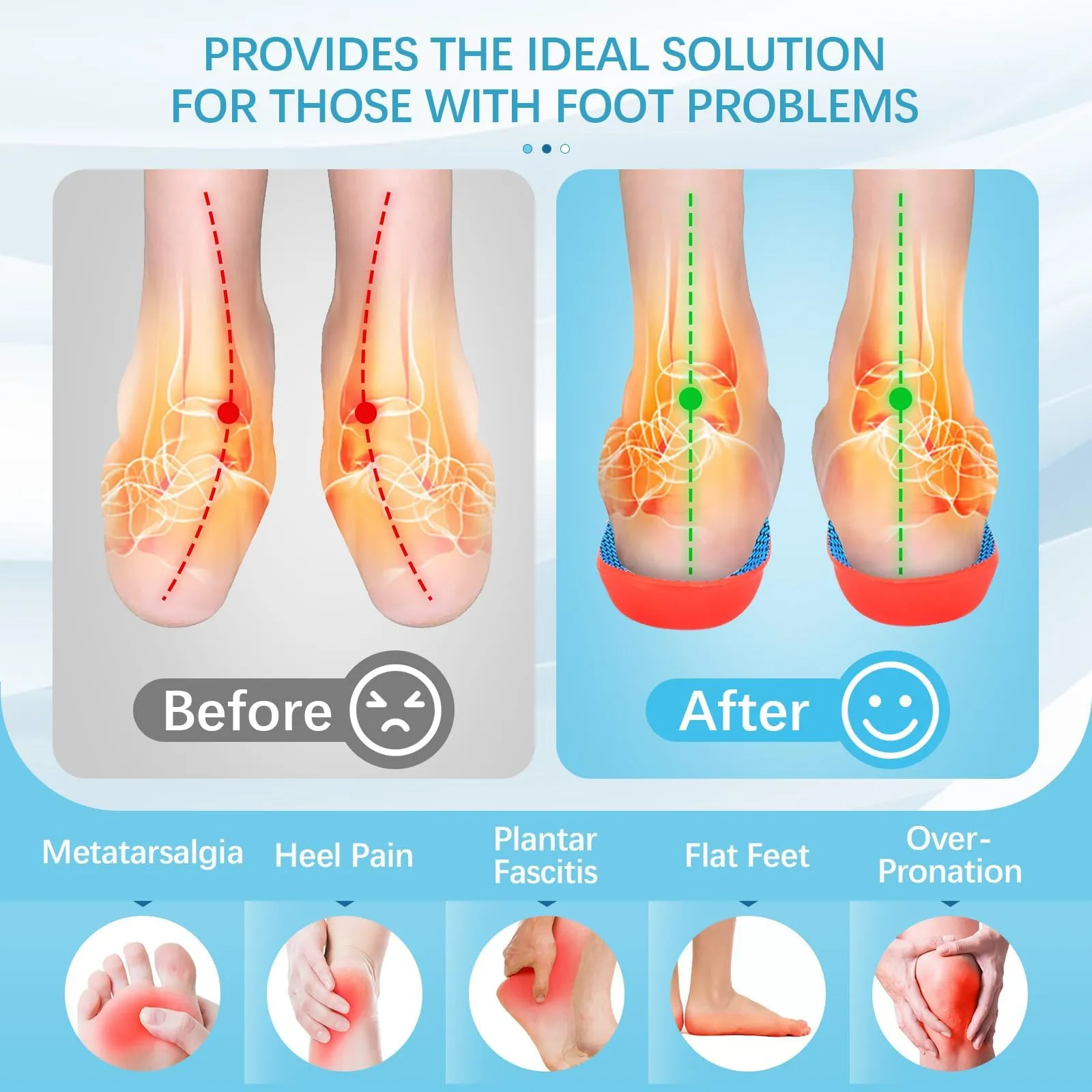 2 pairs of orthopedic insoles, Comfysole heel spur insoles for bunions, plantar fasciitis, men and women, to support the arch of the foot, foot pain 41-42